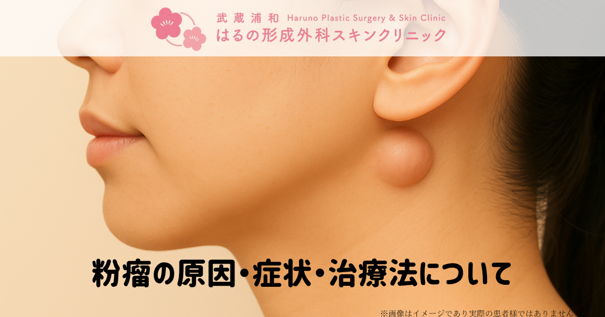 【粉瘤とは？】原因・治療法・手術の流れまで形成外科専門医がわかりやすく解説｜武蔵浦和はるの形成外科スキンクリニック