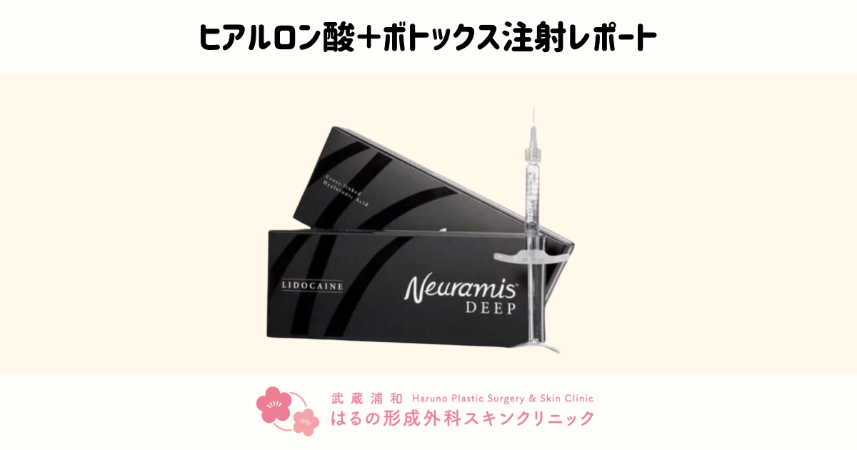 切らずに人中短縮✨ ナチュラルに印象チェンジ【症例写真あり】