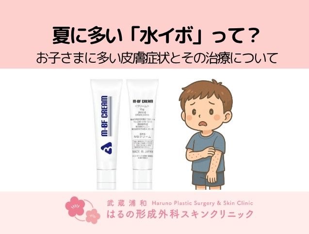 プールの季節に増える「水イボ」って？
