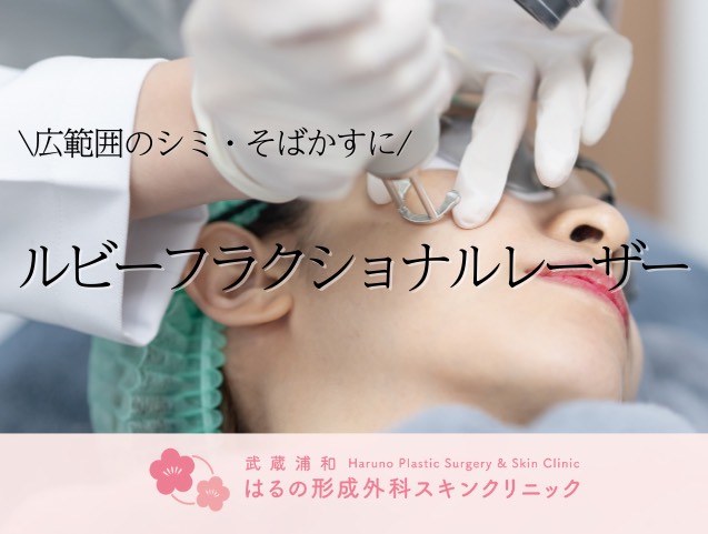 ルビーフラクショナルとは？【症例写真あり】ダウンタイムや経過、施術後のケアについて解説