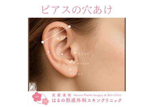 ピアスの穴あけは武蔵浦和はるの形成外科スキンクリニックで♩