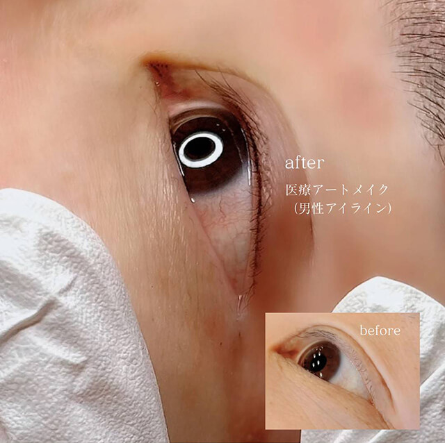 アイラインのビフォー アフター（男性）