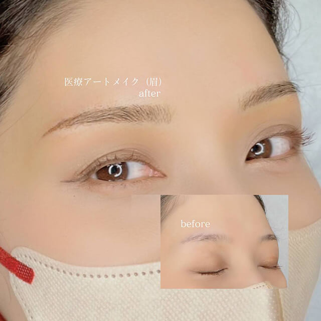 眉のビフォー アフター①
