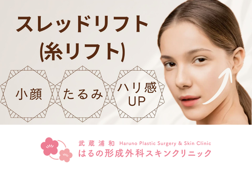 スレッドリフト(糸リフト)でフェイスラインを整える