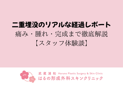二重埋没のリアルな経過レポート｜痛み・腫れ・完成まで徹底解説【スタッフ体験談】