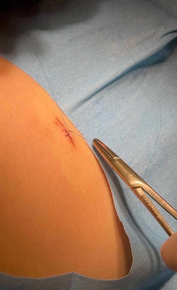 傷跡へのこだわり