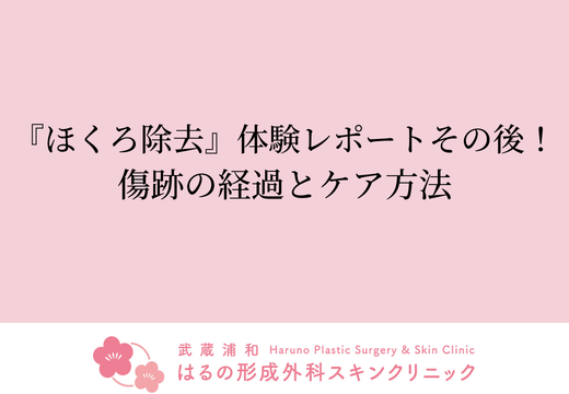 【症例写真あり】『ほくろ除去』体験レポートその後！傷跡の経過とケア方法【形成外科専門医監修】
