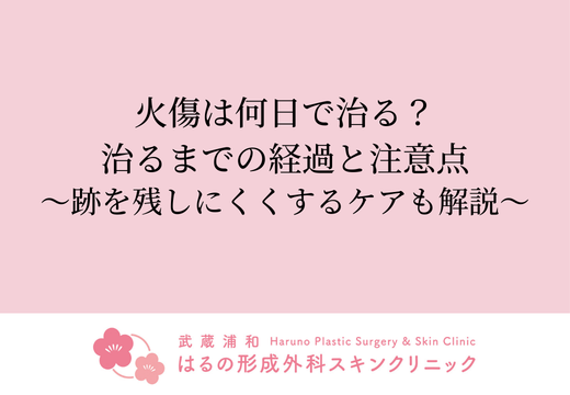 火傷は何日で治る？治るまでの経過と注意点｜跡を残しにくくするケアも解説
