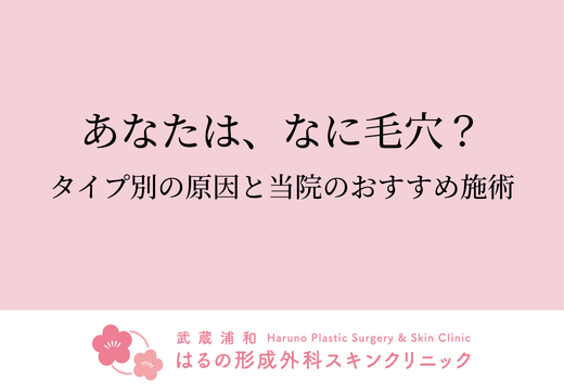 あなたは、なに毛穴？タイプ別の原因と当院おすすめ施術