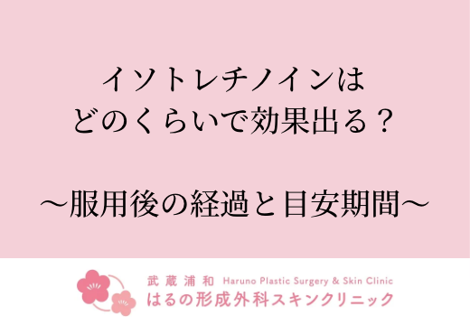 イソトレチノインはどのくらいで効果が出る？〜服用後の経過と目安期間〜