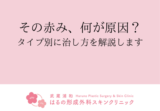 顔の赤みの原因は？タイプ別に治療の考え方を解説します