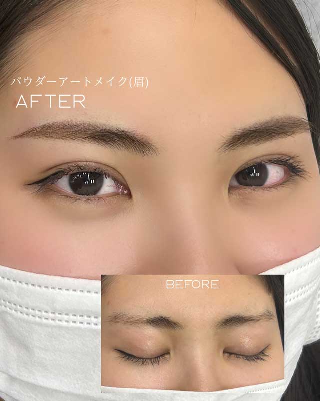 眉のビフォー アフター