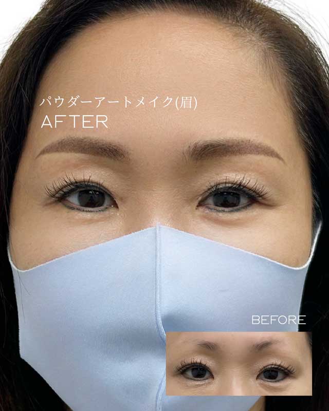 眉のビフォー アフター